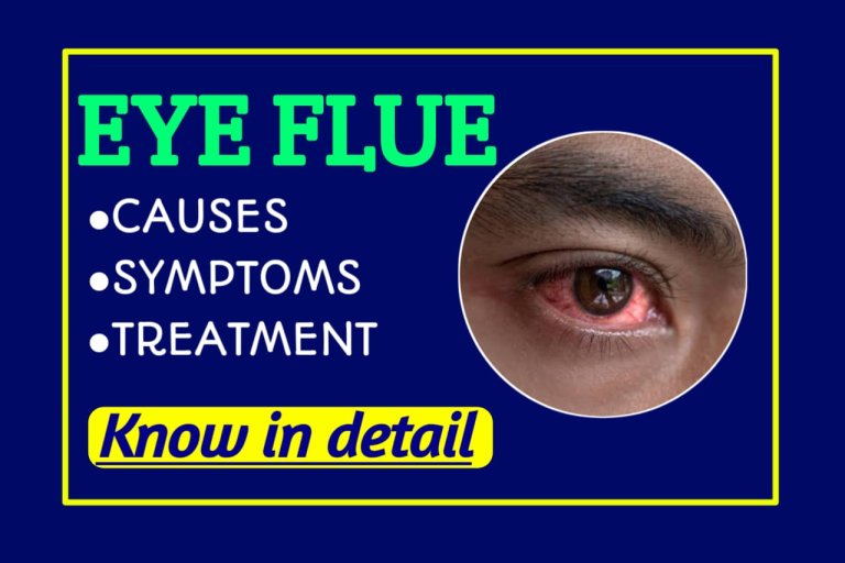 what is Eye flu